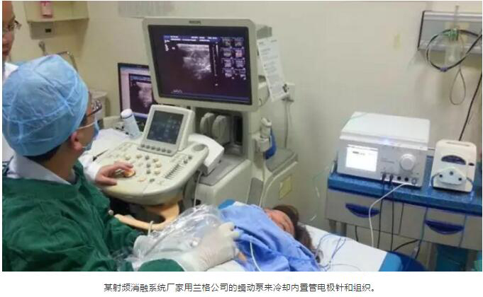 蘭格蠕動(dòng)泵輔助冷極射頻消融系統(tǒng)治療腫瘤